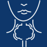 Laryngeal Cancer