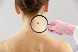 A doctor screening for cancer