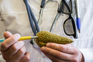 Doctor holding model of the pancreas. 